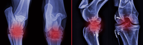 Hock and Stifle Problems in Horses