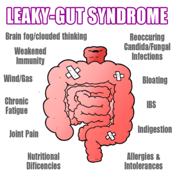 Leaky Gut Syndrome and You