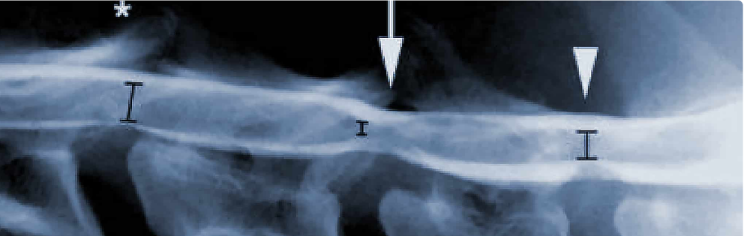 Wobblers Syndrome in Dogs
