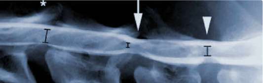 Wobblers Syndrome in Dogs